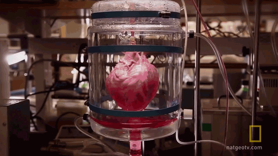 sixpenceee:3D Organ Printing Basic idea behind 3D organ production:(1) Print an