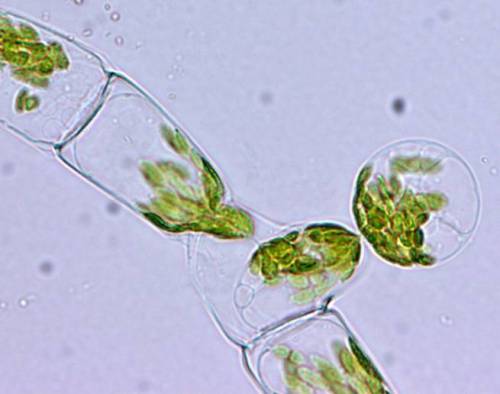 Sex propaedeuticist:  protonemata>plant>sporangium: pictures