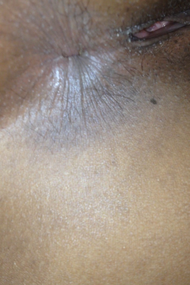 Back Door Black Girls