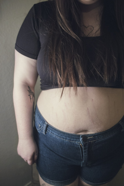 peachyxx:  The intent of this group of photos is to illustrate the countless comments fat women are told by their peers, elders and countless random people on how exactly they should dress. We’re told our bodies are offensive. That the only way to resolve
