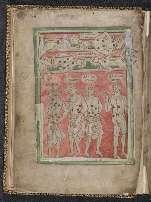 Cautery and surgical diagrams from the Harley 1585 MS.Cautery was a treatment for the relief of pain