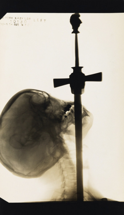 X-ray of Ajax, “The Sword Swallower”1928