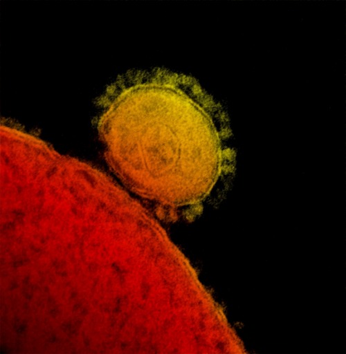 Coloured transmission electron micrograph of novel coronavirus.