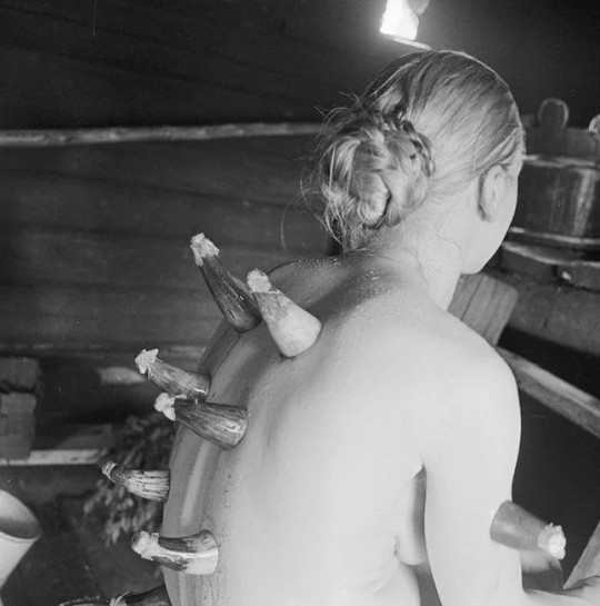 thegreatinthesmall-deactivated2:Horn cupping therapy, Finland, 1935.