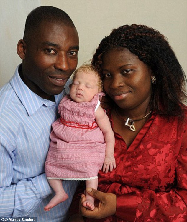 daftlunch:  sixpenceee:  In London 2010, a Nigerian couple gave birth to a blue eyed,