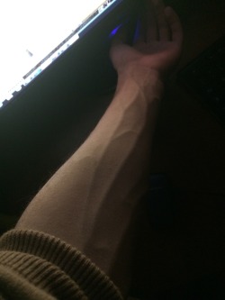 ilragazzoabbandonatodatutti:  Just woke up and my veins were like this