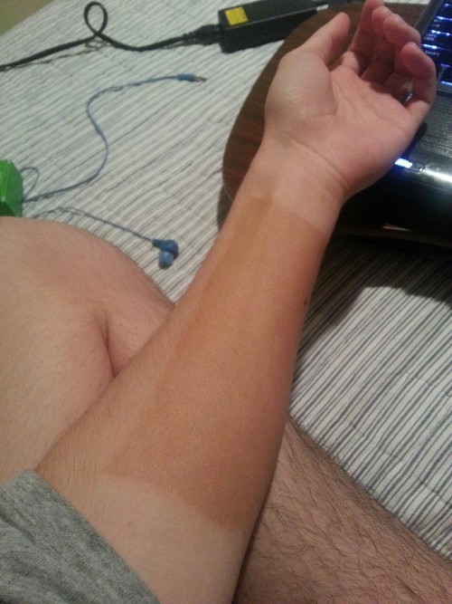 lindsaychrist:  prestoflauto:  troyesivan:  lindsaychrist:  gabriella13702:  lindsaychrist:  strawberryzachary:  lindsaychrist:  i put jergens natural glow on one part of my arm to see what would happen and now i regret it  Wow she really needs to shave