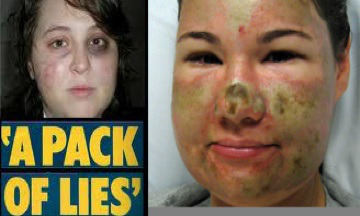 white people make up black attackers: master post.