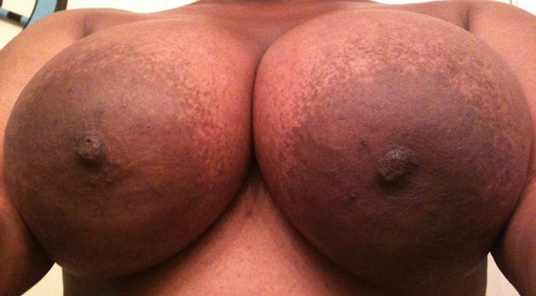 bigwymen:  Nice👍