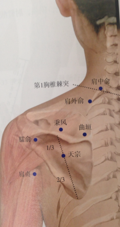 I really like the way these textbooks show points as they fit with musculature and bone, highlighted