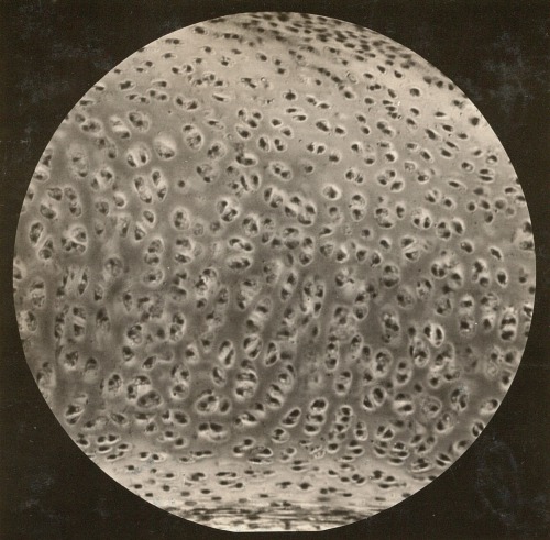 dame-de-pique:  Hyaline cartilage of the human larynx, 1930s 