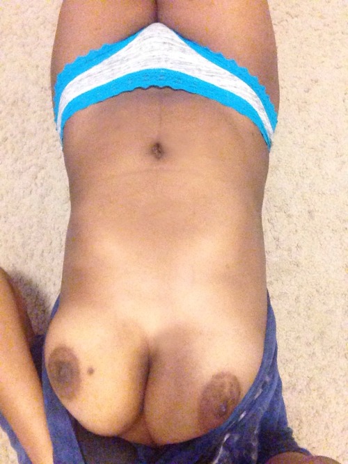 boobsandwolves:I have a terrible scar on my left boob now but since I was away for a while this is well deserved! send me more requests (: