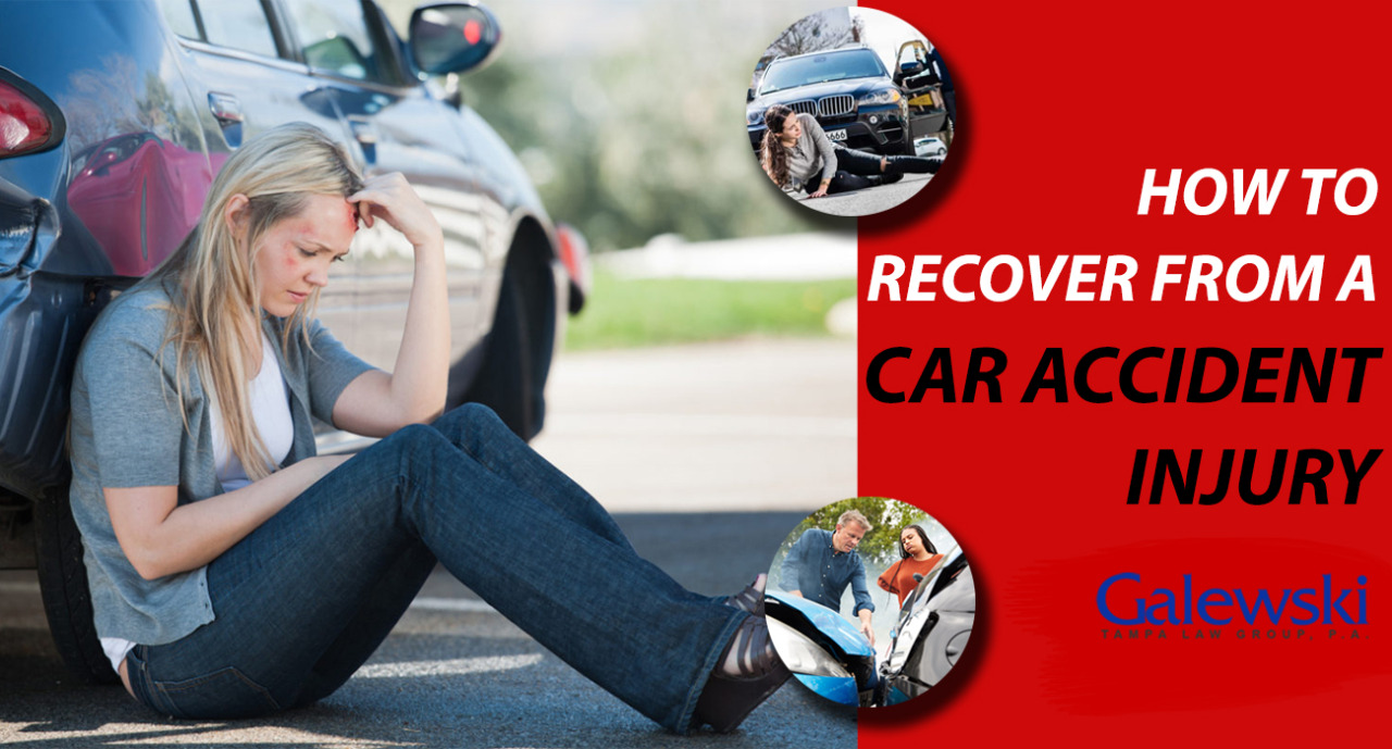 Galewski Law Group (How to Recover from a Car Accident Injury)
