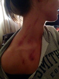 s0phisticatedh00drat:  So make up sex while being high is just the best sex and my girl looks so fucking sexy covered in hickeys. So there’s that.