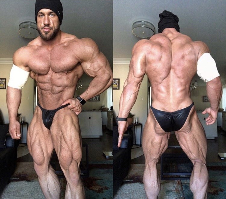 Antoine Vaillant - Sad to say but Antoine suffered a bicep tendon tear and is now