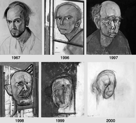 verminunrest:  scumbeg:  A self-portrait made by an artist with alzheimer.    