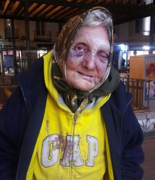   &ldquo;Se llama Flor. Hace 3 años su único techo era la polución del cielo madrileño. Una madrugada, varios nazis se acercaron hasta los cartones sobre los que dormía y le patearon la cabeza y el cuerpo hasta dejarla inconsciente.Y es que Flor,