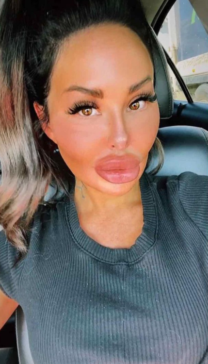 faketittilyoumakeit: Big fake lips are beautiful.