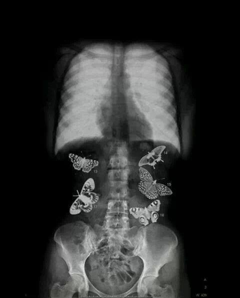   La escasez de comida se vuelve deliciosa porque tenemos la barriga llena de mariposas&hellip;