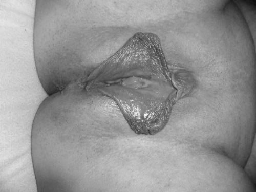 31colonel: Beautiful lips, these deserve lots of attention.