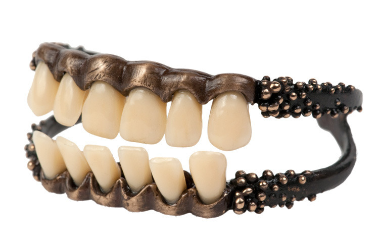 exocutis:  Maxillary and Mandibular BanglesDental Cuff