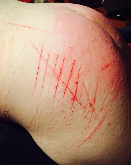 baabycunt2:  another-nail-in-my-coffin:  aliglaz:  bruisedmmmmuse:  sick-young-man:  This girl got play time with daddy today. For every 10 swats of the cane she took without squirming or running away she received a mark to remind her. I’m so proud
