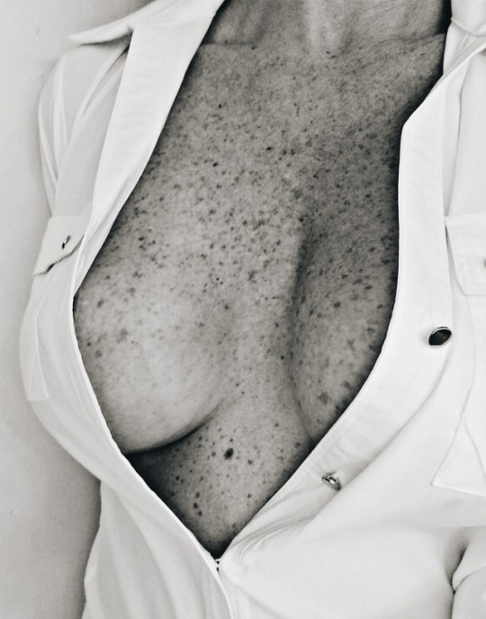 curious2know1:  “Those freckles make you seem like a galaxy of stars, just waiting