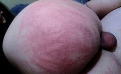 cyberslutlexi: i was such a dumb slut, and I got caned a bunch, are my bruises pretty?  