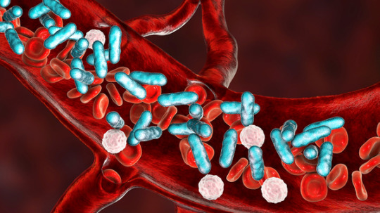 Sepsis, which is sometimes called blood poisoning, is essentially the body