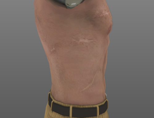 I Wanted To Do This For Ages And Didnt Know How To, But I Persevered. So BEHOLD!!! Ocelots Scars