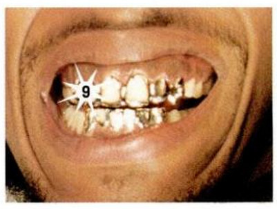 GUESS THE GRILLZ Answer here.