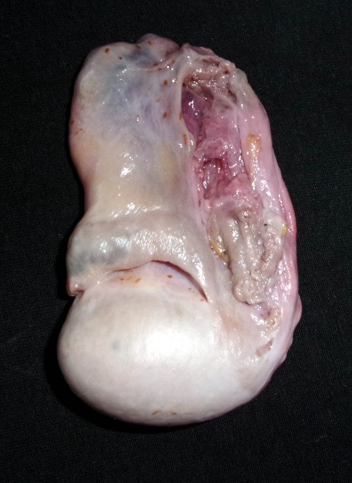 juliusmr: Detailed view of my left testicle