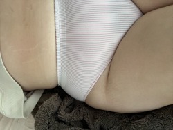 xoxothickbitch:Stretch mark appreciation porn pictures