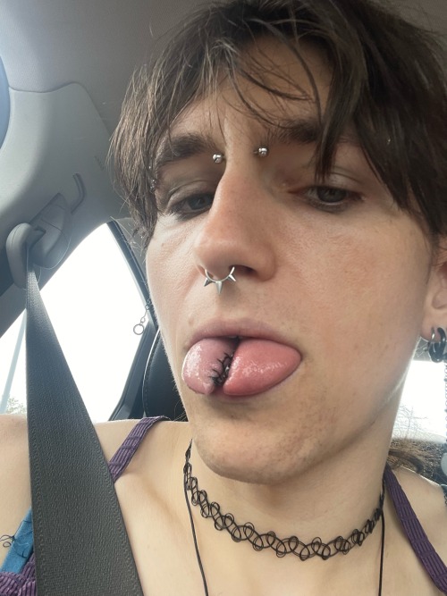This Is How I Feel Rn. It Is Currently Day Three Of Me Splitting My Tongue And Day Three Has Been By