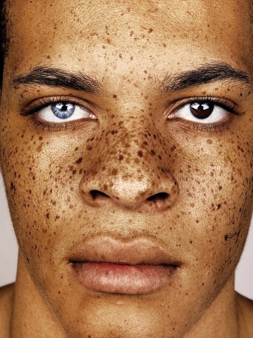 jilkos: “connecting the dots and ​finding beauty in freckles” Photographer Mr Elbank Model Kaine Bu