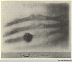 design-is-fine:  Wilhelm Röntgen, Hand mit Ringen, 1895. Photo @ Bettyann Holzmann Kevles  The first published X-ray was of the human hand, that of his wife Anna Bertha. Röntgen presented it in a formal paper Dec 1895. A Viennese newspaper picked