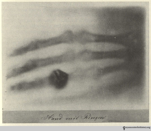 design-is-fine:  Wilhelm Röntgen, Hand mit Ringen, 1895. Photo @ Bettyann Holzmann Kevles  The first published X-ray was of the human hand, that of his wife Anna Bertha. Röntgen presented it in a formal paper Dec 1895. A Viennese newspaper picked