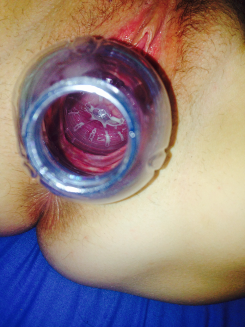 kinkycouplehavingfun:  We used a smaller bottle this time and it looks amazing. I think we need to find a tube or cylinder so I can give her cervix a real good inspection. Also it would allow me to see what my cum and spit looks like inside her beautiful
