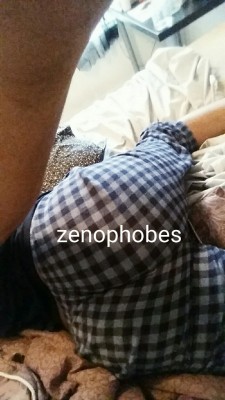 zenophobes:  Before n after 