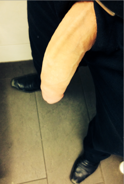 Xlbig:  Monster White Cock                                 Http://Xlbigdick.com @Xlbigx   .Bulge    Submit