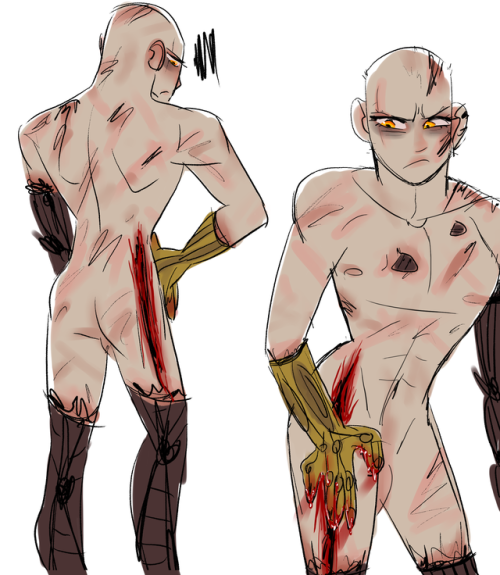anakinspajamas:Ugh, another scar for the collection…