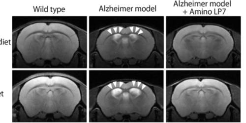 Low Protein Diets Could Accelerate Dementia but Amino Acids Can Slow the ProgressWhile a low-protein