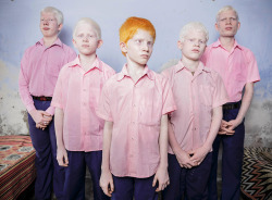 artexpansion:Brent Stirton - Blind Indian Albino Boys (2014)