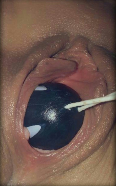 share-your-pussy:  @770701 @yummyilovethis  Submit your cunt here @share-your-pussy  Email:shareyourpussies@mail.com  My Reblog: @yummyilovethisJennifer xxx 