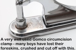 circ-n-squeal:  Literally hundreds of baby boys squealed in the Circumstraint because of this veteran Gomco clamp.  So cruel but true 