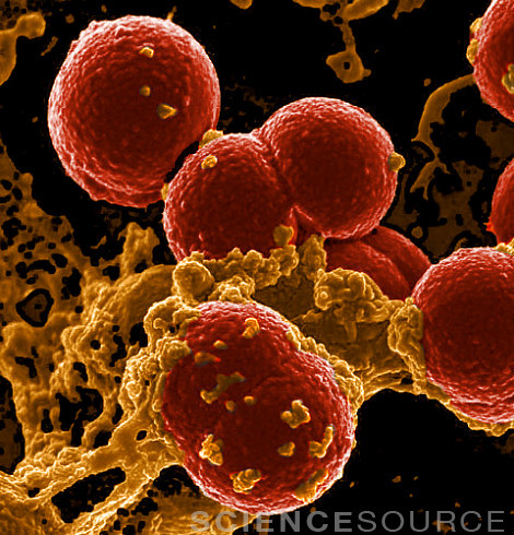 Image JC3202 (Neutrophil Ingesting MRSA Bacteria)Colorized scanning electron micrograph of Neut