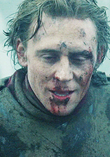 hxcfairyhasmoved:  Tom Hiddleston - beaten,