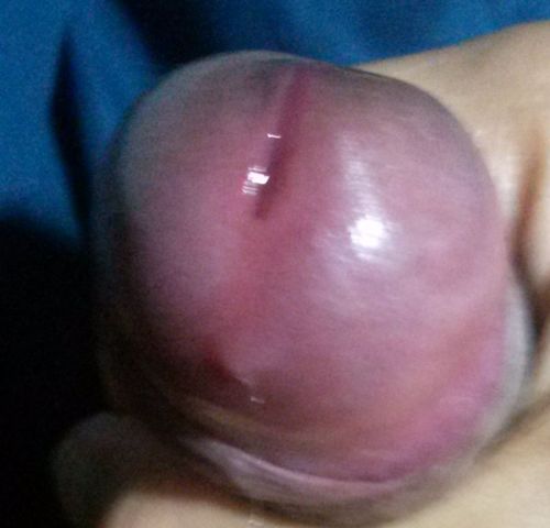 darthjoey:  just the tip compilation of me. Oh look, there’s a cum in one of the pics.