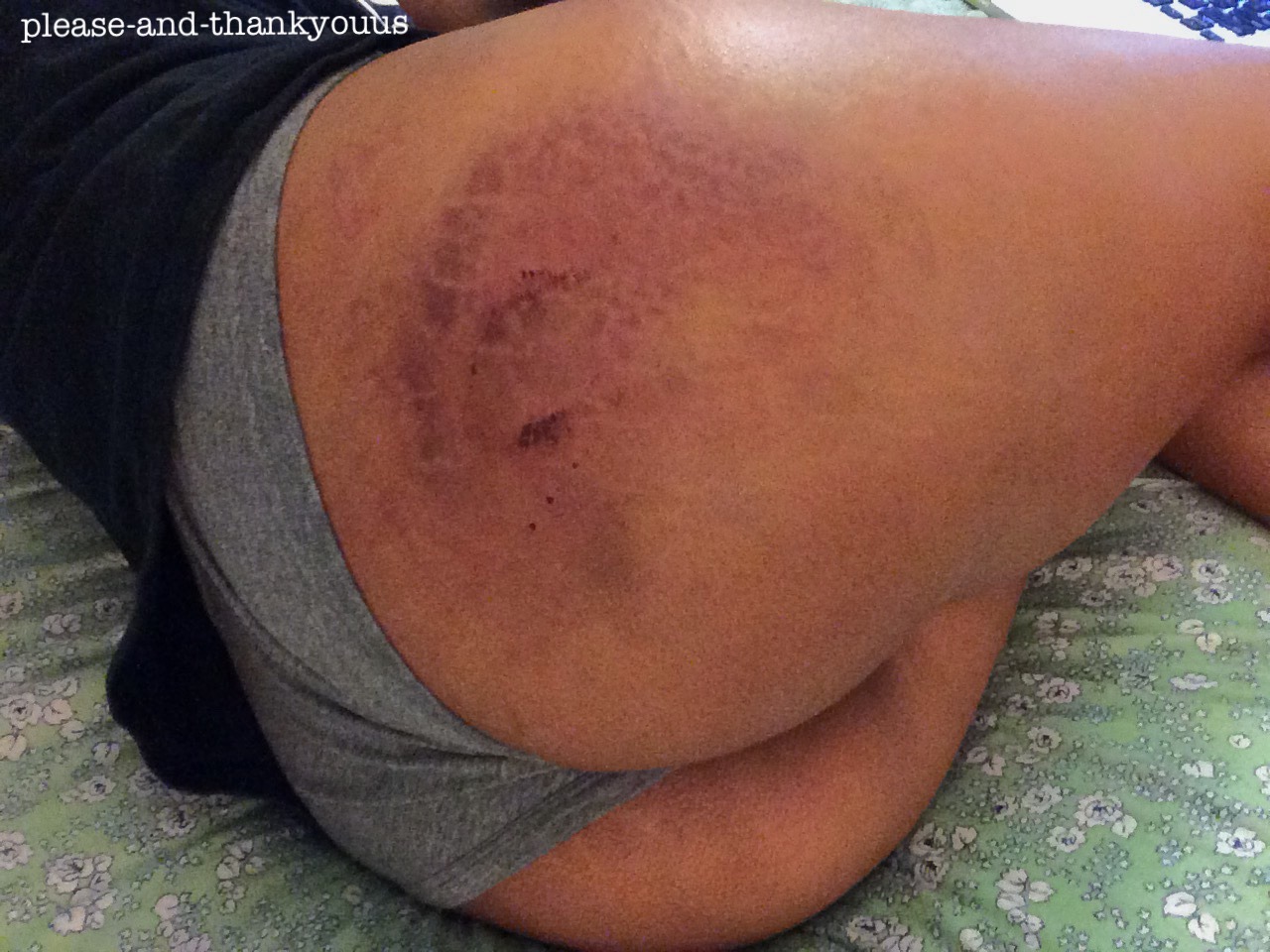 please-and-thankyouus:  prettylittlevictim:  please-and-thankyouus:  Ouch ☺️