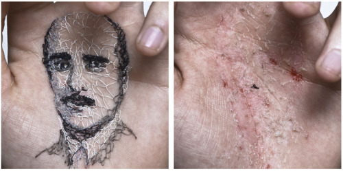 f-l-e-u-r-d-e-l-y-s:  Hand Sewn portraits by David Catá  Does love really has to hurt? According to artist David Catá it obviously does. The Spanish artist uses his body as a canvas, writing an autobiographical diary. In his ongoing series ‘A Flor